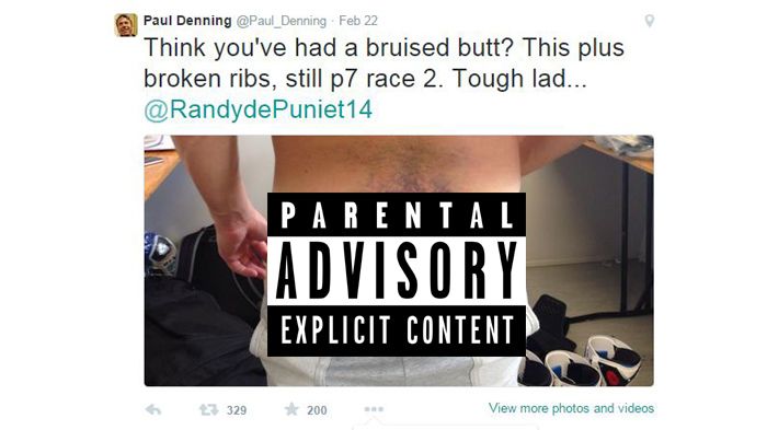 Ουπς. Αυτή η μελανιά του de Puniet σίγουρα πονάει. Δεν ξέρουμε βέβαια αν πονάει πιο πολύ από τη δημοσιοποίηση της φωτό από τον Paul Denning.