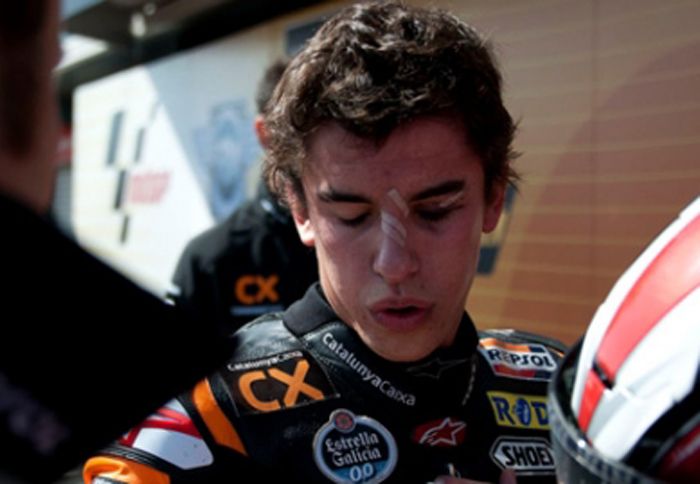 O Marc Marquez αναρρώνει μετά από επιτυχημένη επέμβαση που έκανε στο δεξί του μάτι.
