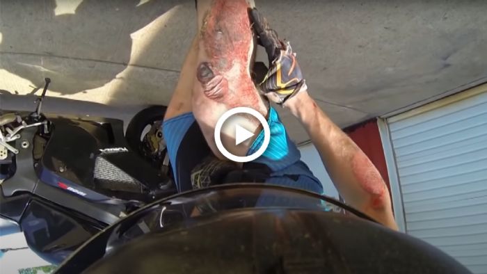 VIDEO: Το αποτέλεσμα μιας πτώσης χωρίς προστατευτικά ρούχα VIDEO: Το αποτέλεσμα μιας πτώσης χωρίς προστατευτικά ρούχα